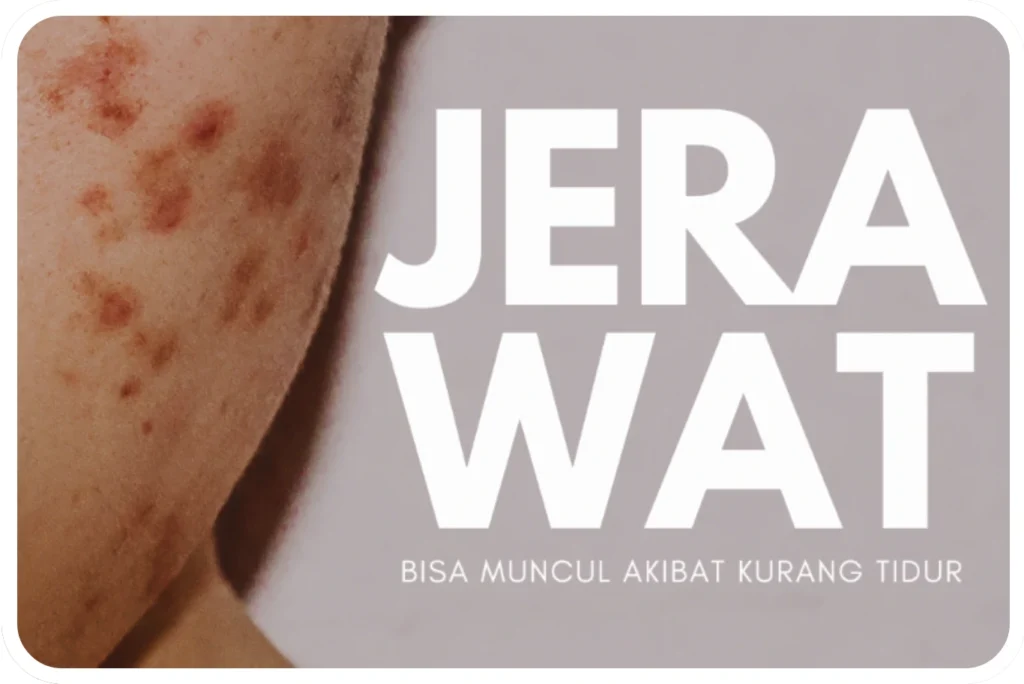 prototipe 2025 10 09t170001.162